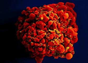 Выявлен второй в мире случай естественного излечения от ВИЧ