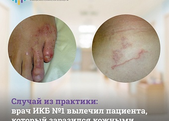 Врач ИКБ №1 вылечил пациента, заразившегося кожными паразитами на отдыхе